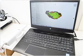 口腔内3Dスキャナー