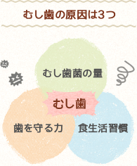 むし歯の原因は3つ、むし歯＝むし歯菌の量、歯を守る力、食生活習慣